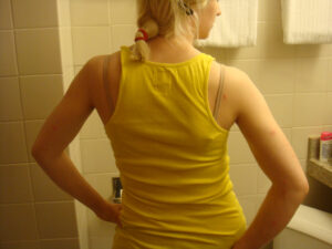 3891154103_84ac578358_b_back-pain